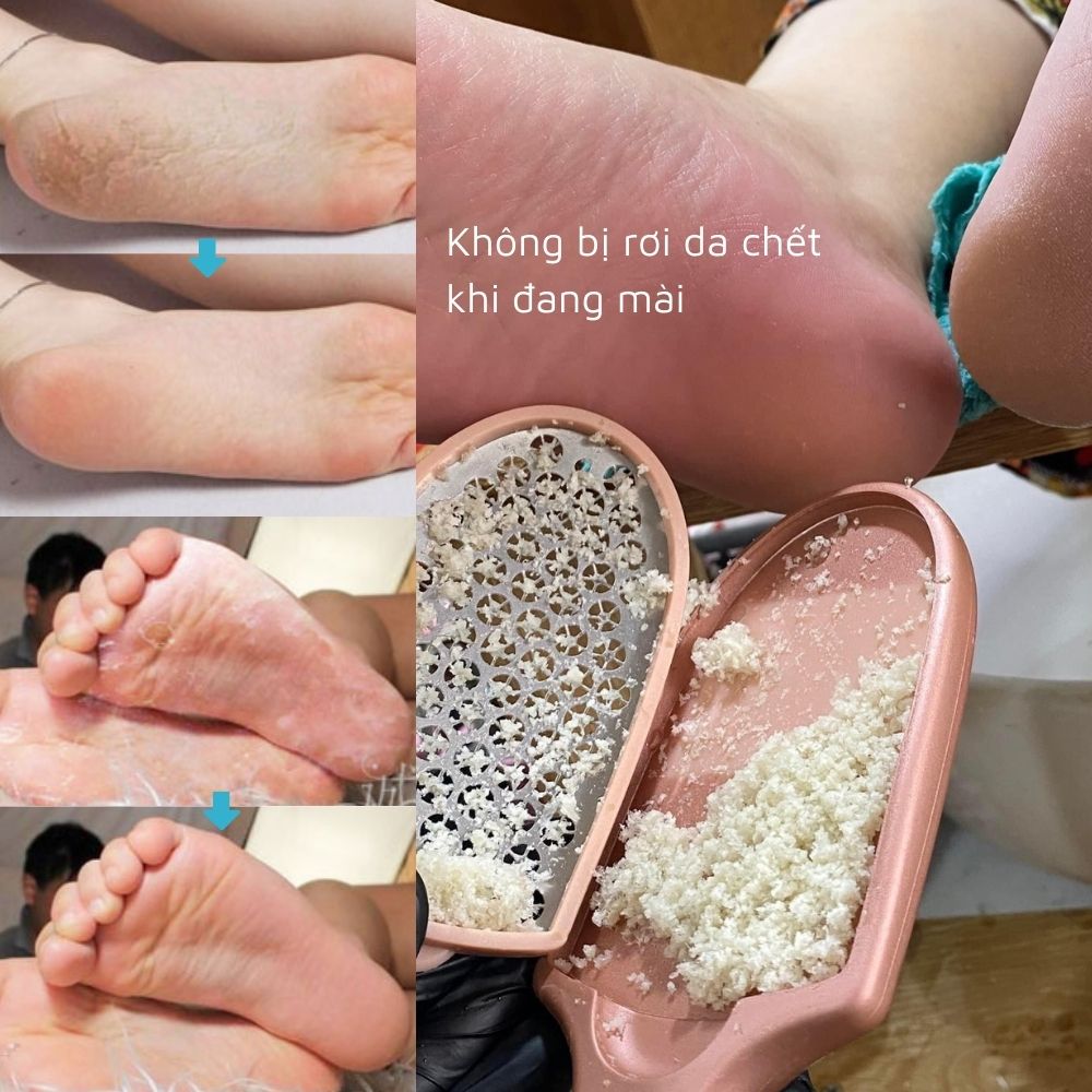 Cây chà gót chân inox đa năng 2 in 1