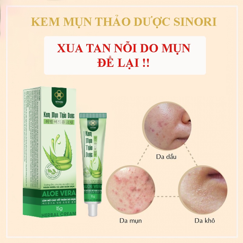 KEM TRỊ MỤN THẢO DƯỢC SINORI