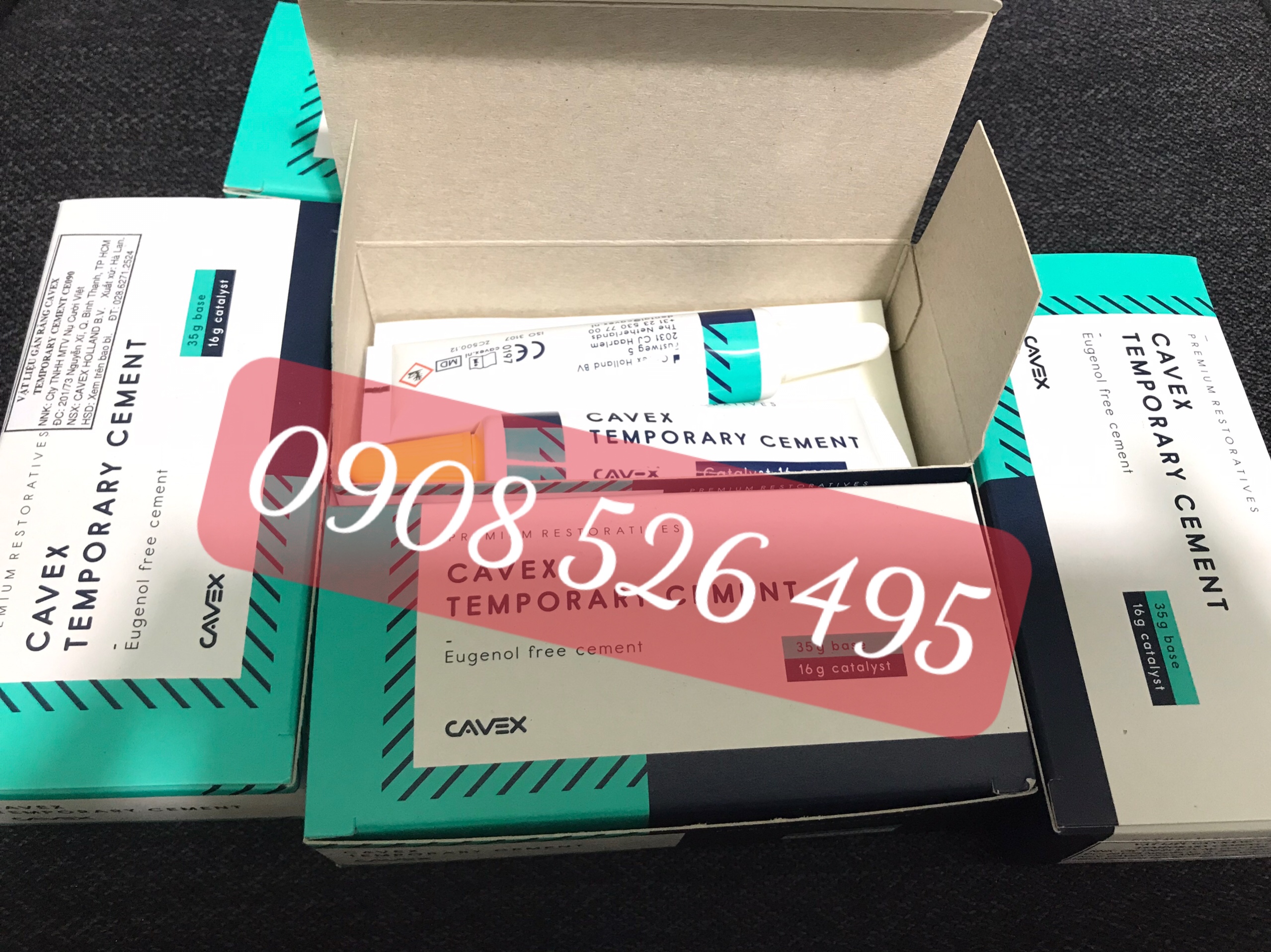 Gắn tạm Cavex Hà Lan