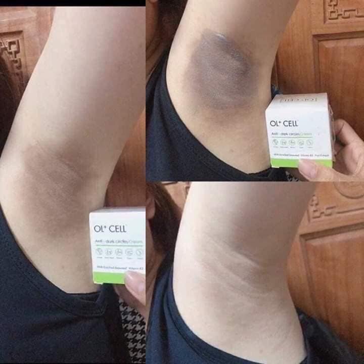 kem OL CELL giảmTHÂM HÀN QUỐC
