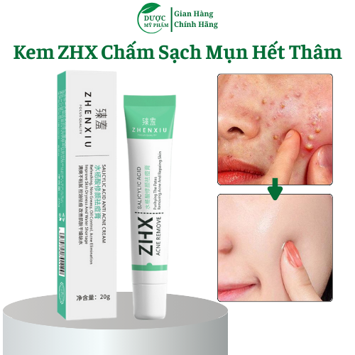 Kem Hết Mụn Loại Bỏ Mụn và Vết Thâm Hoàn Toàn Thu Nhỏ Lỗ Chân Lông Kiểm Soát Dầu Dưỡng ẩm và Nuôi Dưỡng Da Cao Cấp 20G