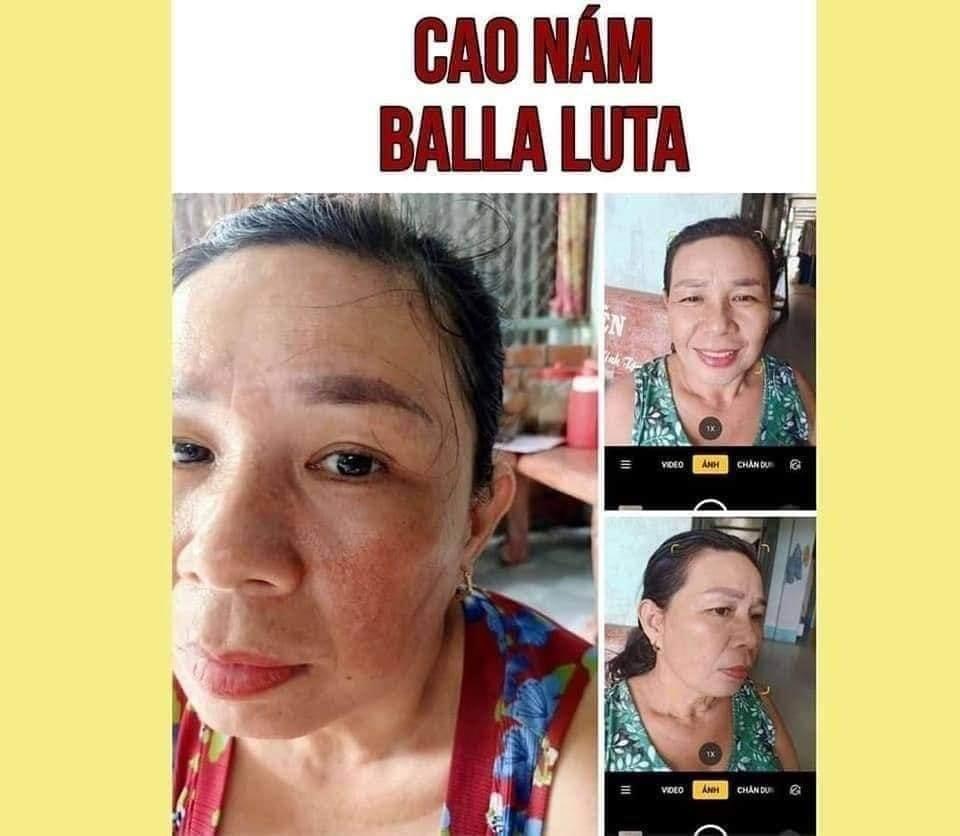 [HCM]CAO NÁM BALLA LUTA -  MỜ NÁM SẠM DA