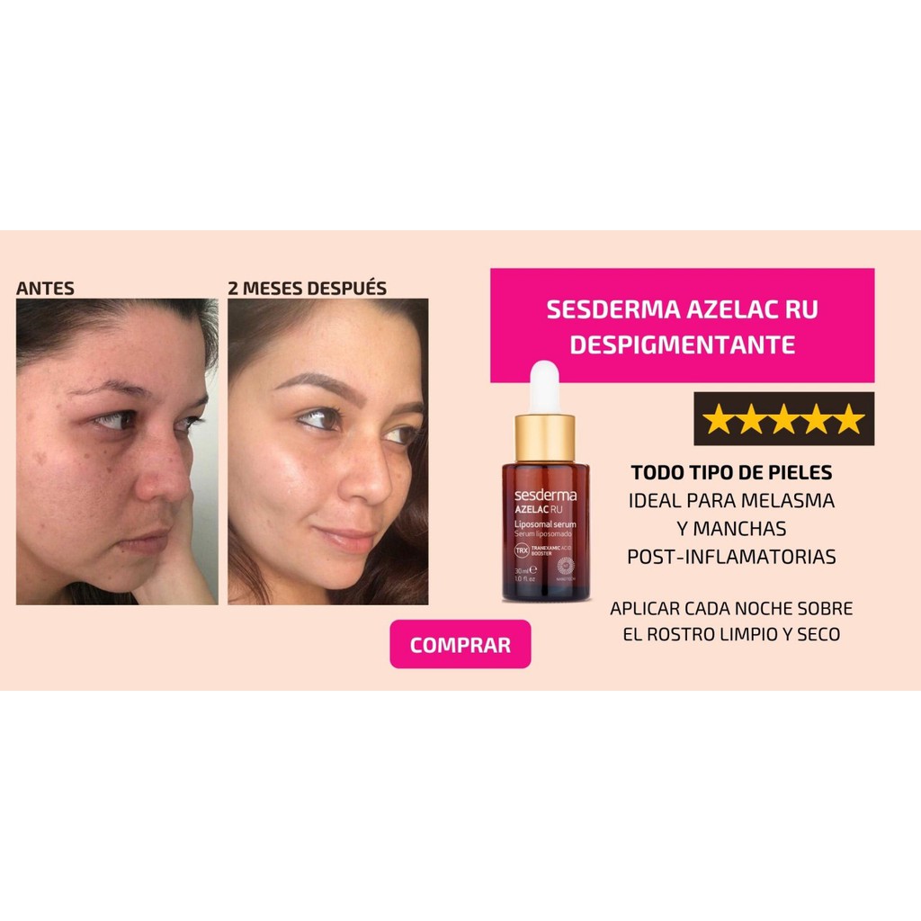 [CHÍNH HÃNG] Serum Sesderma Azelac Ru Liposomal Sáng Da Mờ Thâm Nám