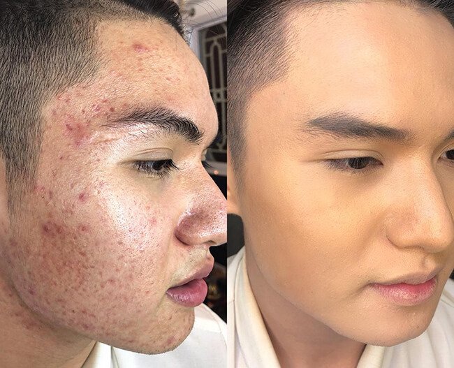 [HCM]Tái Tạo Cao Cấp - Serum Bà Lão