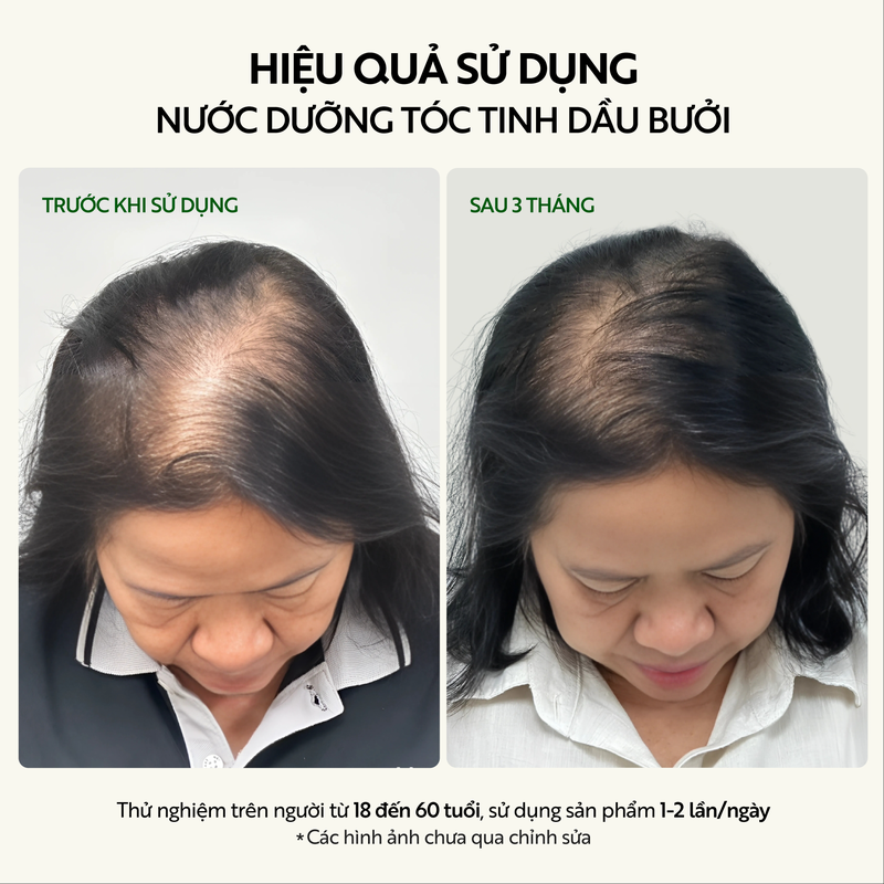 Bigsize - Nước dưỡng tóc tinh dầu bưởi Cocoon 310ml