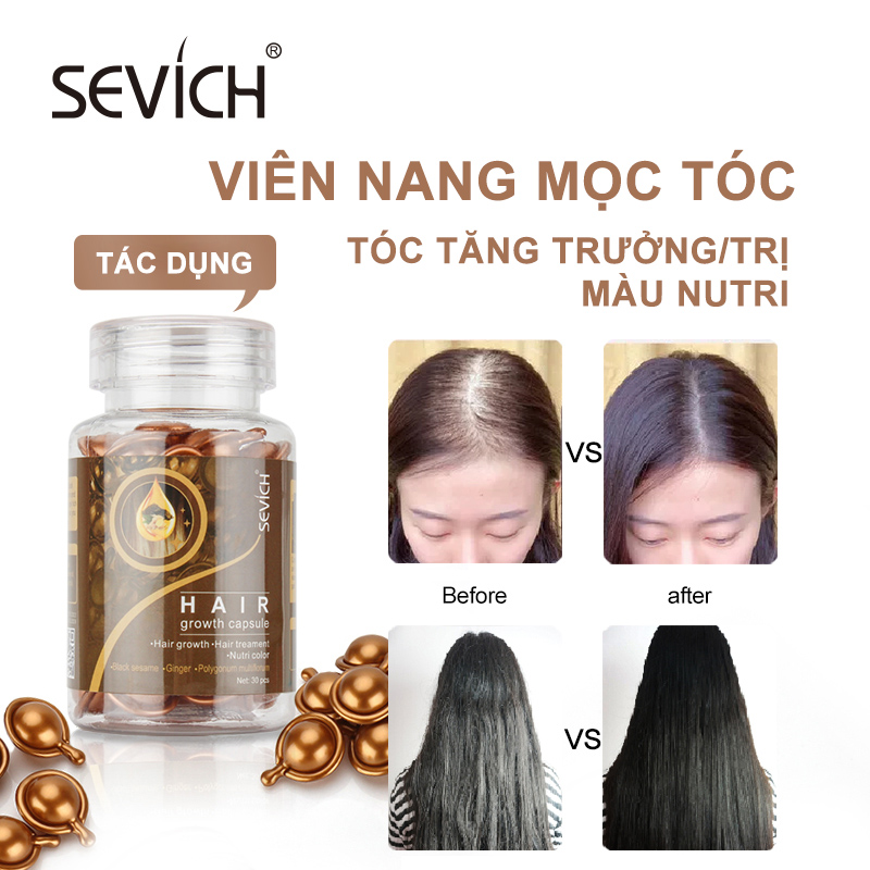 SEVICH Hair Nourishing Capsules Promote Hair Growth and Prevent Hair Loss Ginger Hair Nourishing Oil