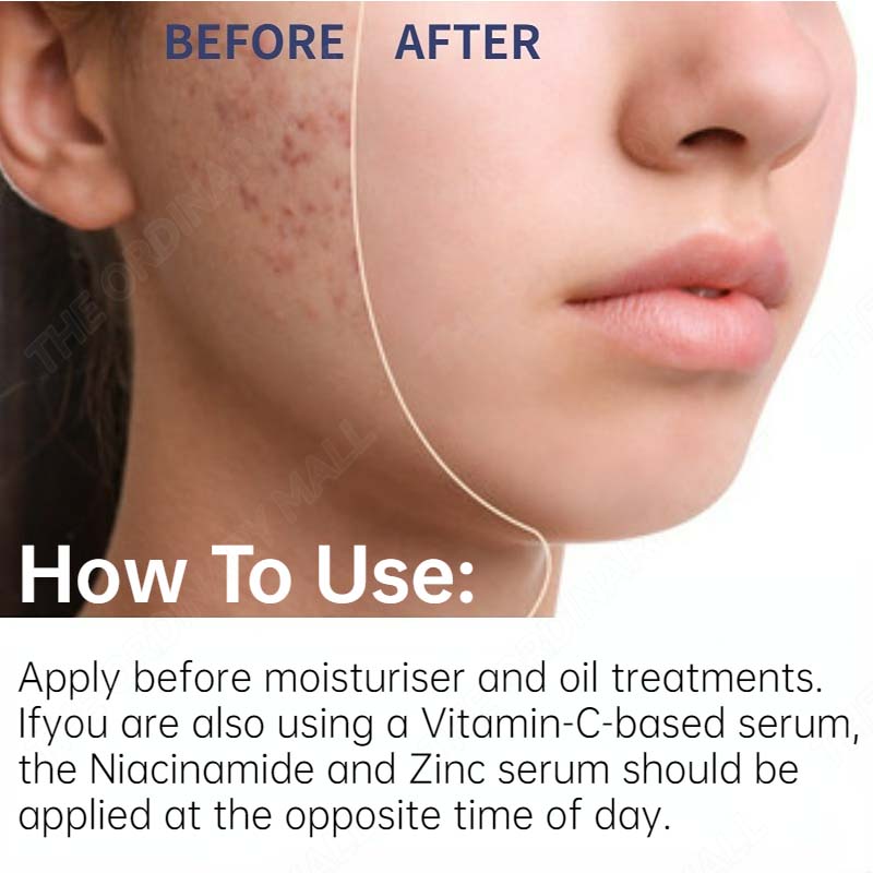 Serum the ordinary Niacinamide 10% + Zinc 1% Serum dưỡng da phục hồi da chính hãng
