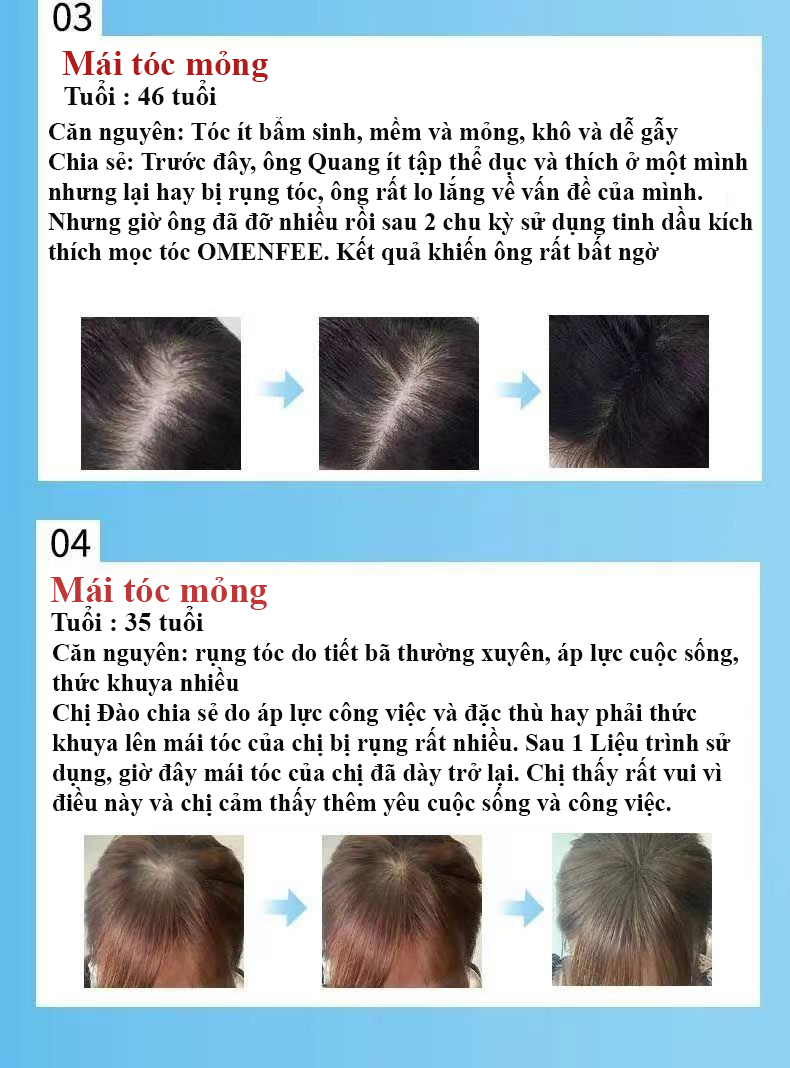 Kích Mọc Tóc OMENFEE, Serum Omenfee kích thích mọc tóc, Tinh Chất Kích Thích Mọc Tóc