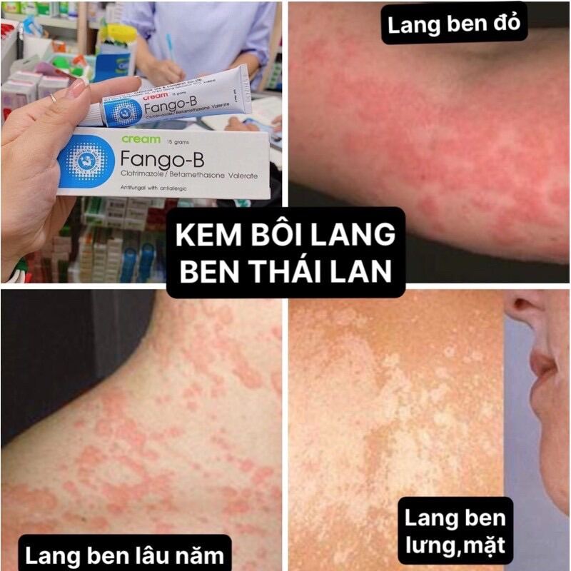 Kem Bôi Lang Ben FANGO-B Cream Thái Lan 15g