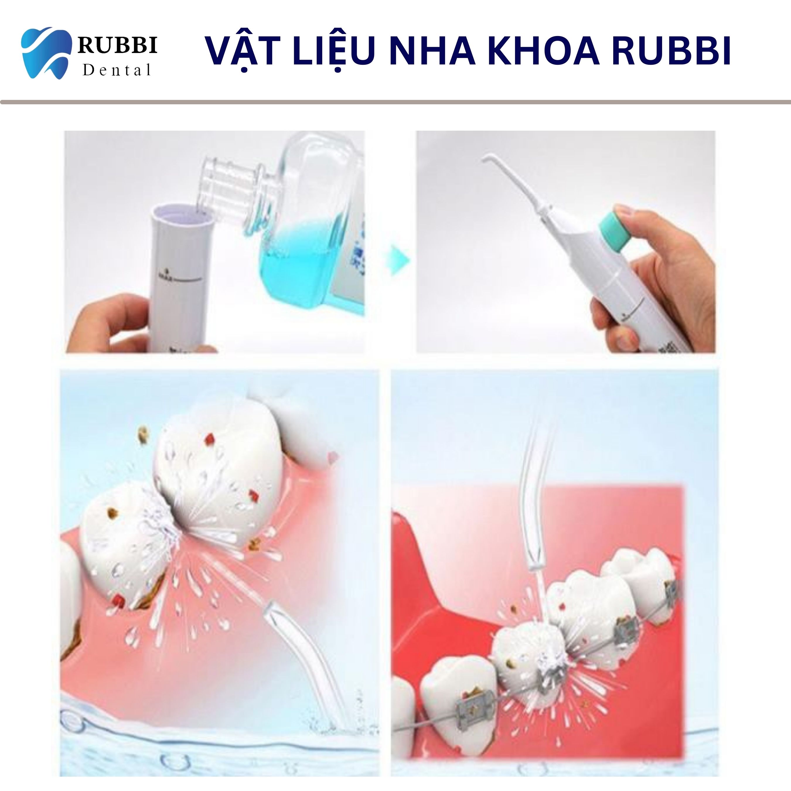 Máy tăm nước cơ, vệ sinh răng miệng Power Floss