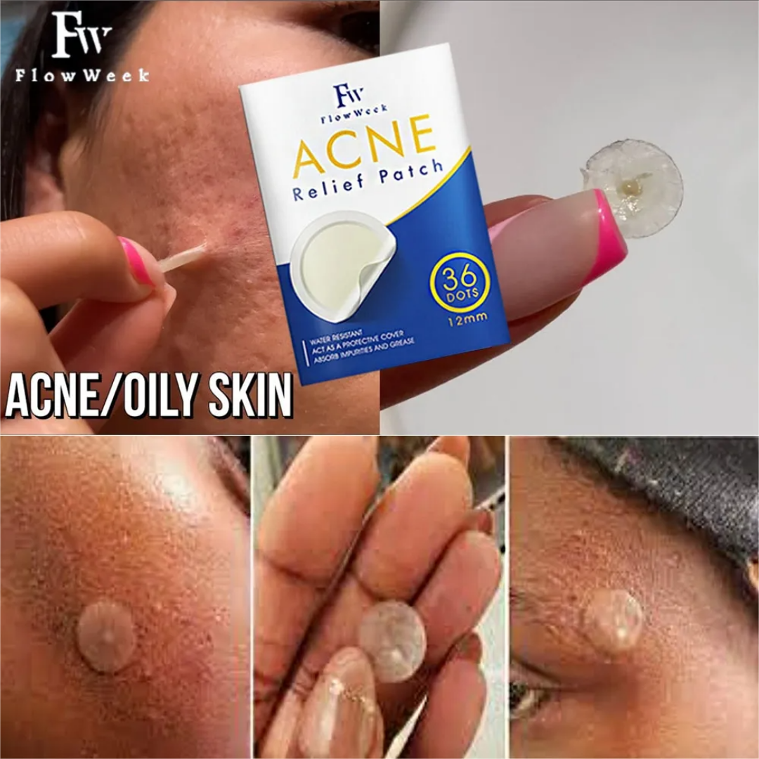 Flow Week Miếng dán trị mụn Miếng dán trị mụn Hydrocolloid Miếng dán trị mụn không thấm nước Miếng dán trị mụn Hydrocolloid Miếng dán trị mụn vô hình thoáng khí Miếng dán chống mụn trên mặt