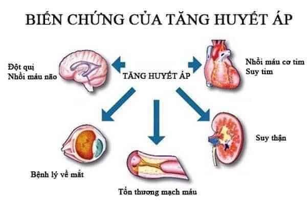 Trà Giảo cổ lam Thái Hưng