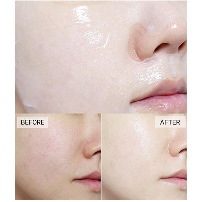 [HCM]Mặt Nạ BNBG Hàn Quốc - Vita Genic Mask 30ml