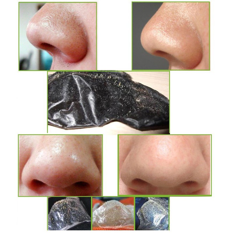 Gel Lột Mụn Than Hoạt Tính