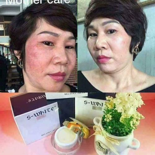 kem face nám cao cấp swhite -hàng cty