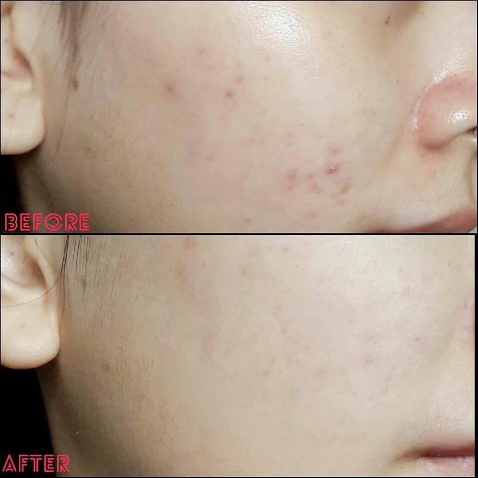 Serum Estee Lauder Advanced Night Repair Fullbox