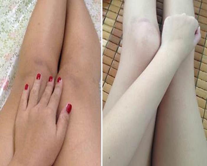TẮM TRẮNG KHÔ ĐÔNG TRÙNG CÁT