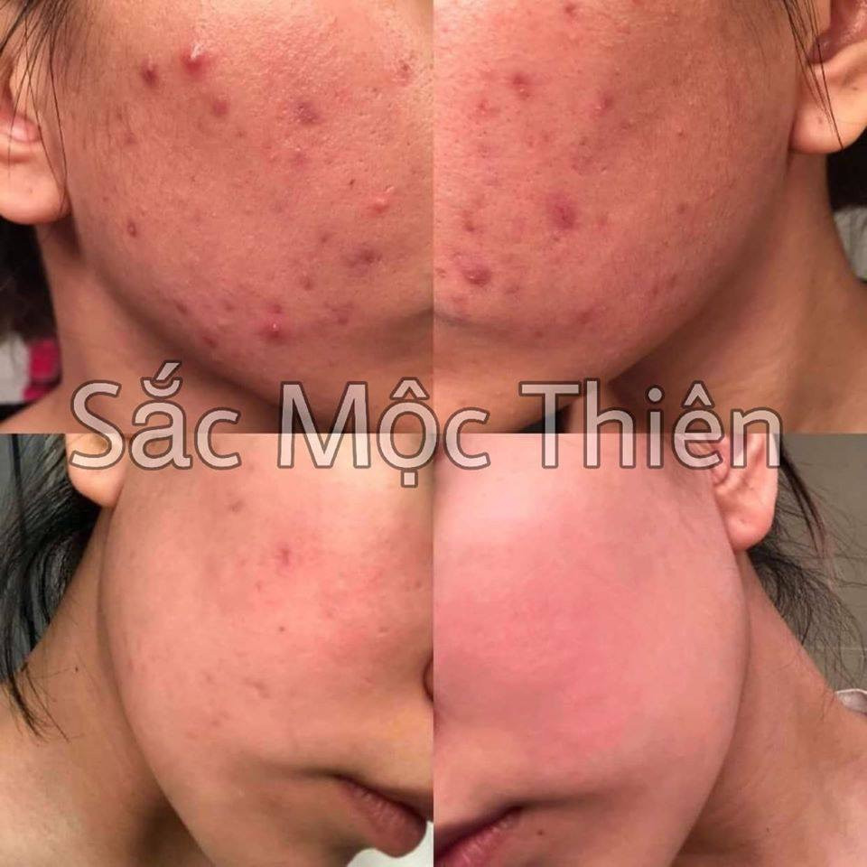 [HCM]Linh Chi Bột rửa mặt Sắc Mộc Thiên 90GR