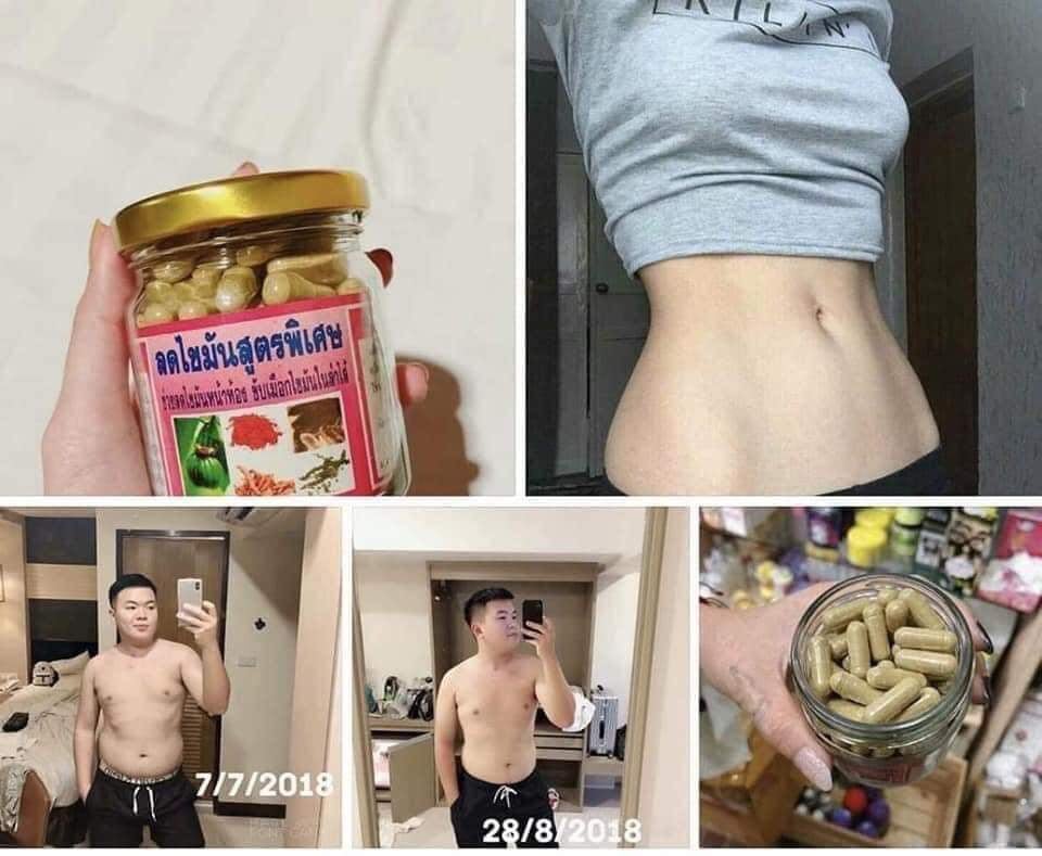GIẢM CÂN ĐÔNG Y Thái Lan