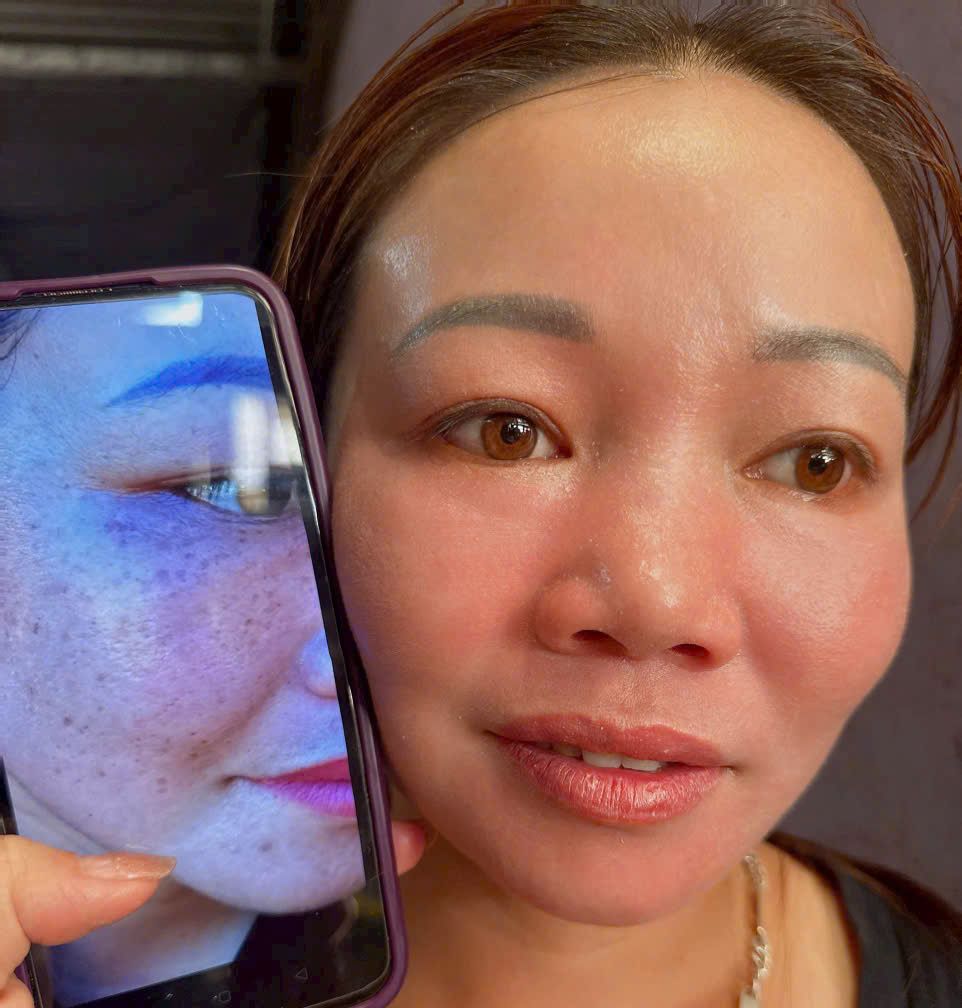 Srum Tái Tạo Yody Phương Anh làm đẹp da mụn nám tàn nhang da không đều màu