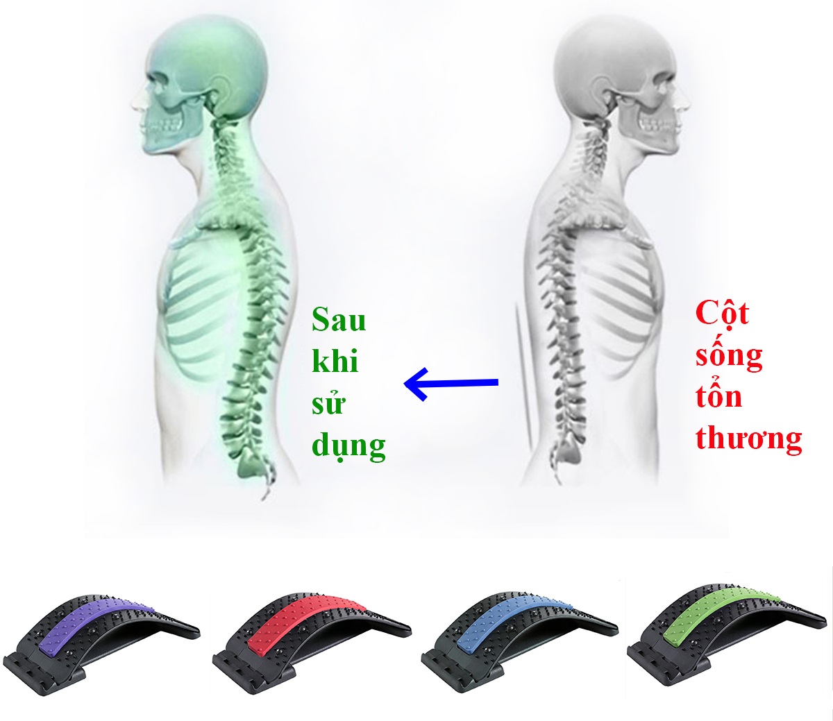 Khung Nắn Chỉnh Cột Sống Và Massage Hỗ Trợ Tập Lưng, Giảm Thoái Hóa Đốt Sống Lưng, Đốt Sống Cổ Và Thoát Vị Đĩa Đệm, Dụng Cụ Chăm Sóc Khỏe Thiết Kế Mới