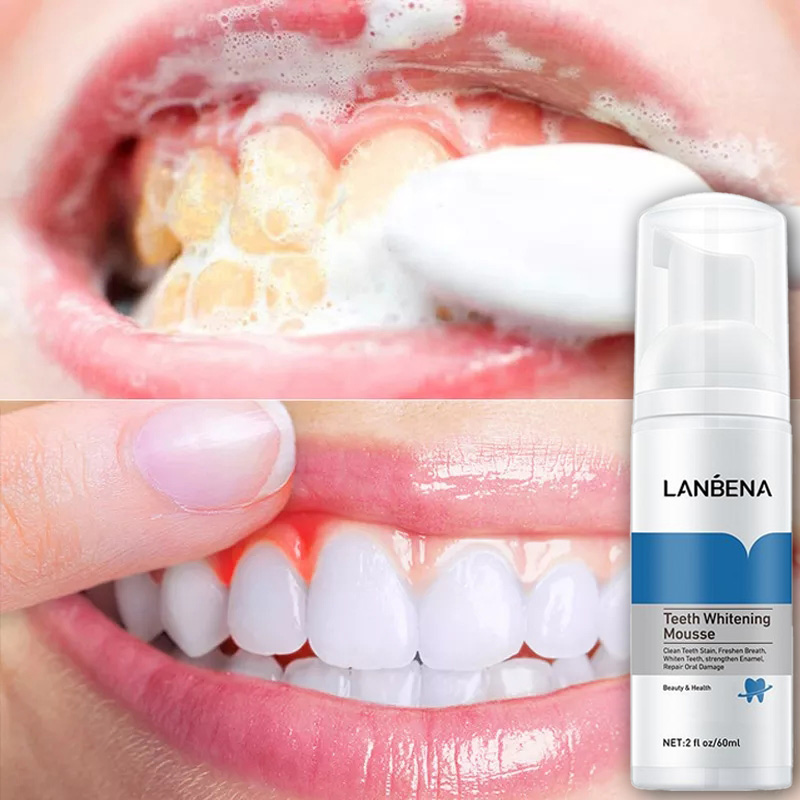[HCM]LANBENA Mousse trắng răng Làm sạch răng Làm trắng răng Teeth Whitening Mousse