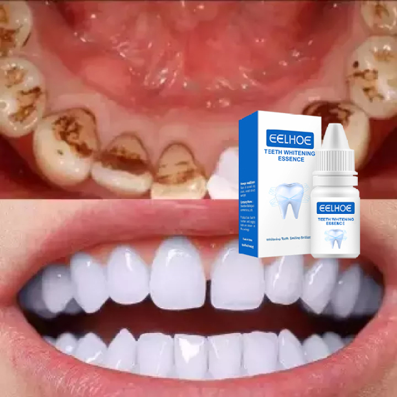 Tinh chất tẩy trắng răng làm sạch răng khử mùi hôi miệng hiệu quả 15ml eelhoe - INTL