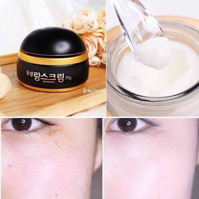 [HCM]Kem Nám Dongsung Rannce Cream mini 10g