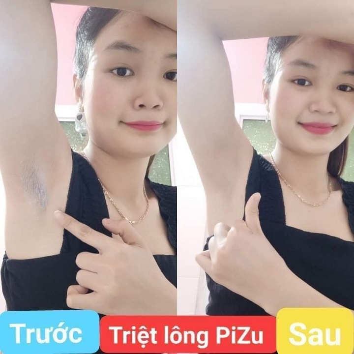 Kem tẩy lông pizu