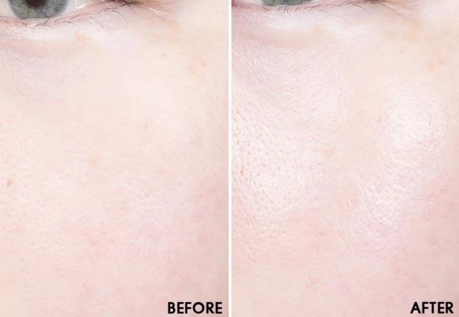 Nước hoa hồng Dr Pepti+ Centella Toner - 180ml