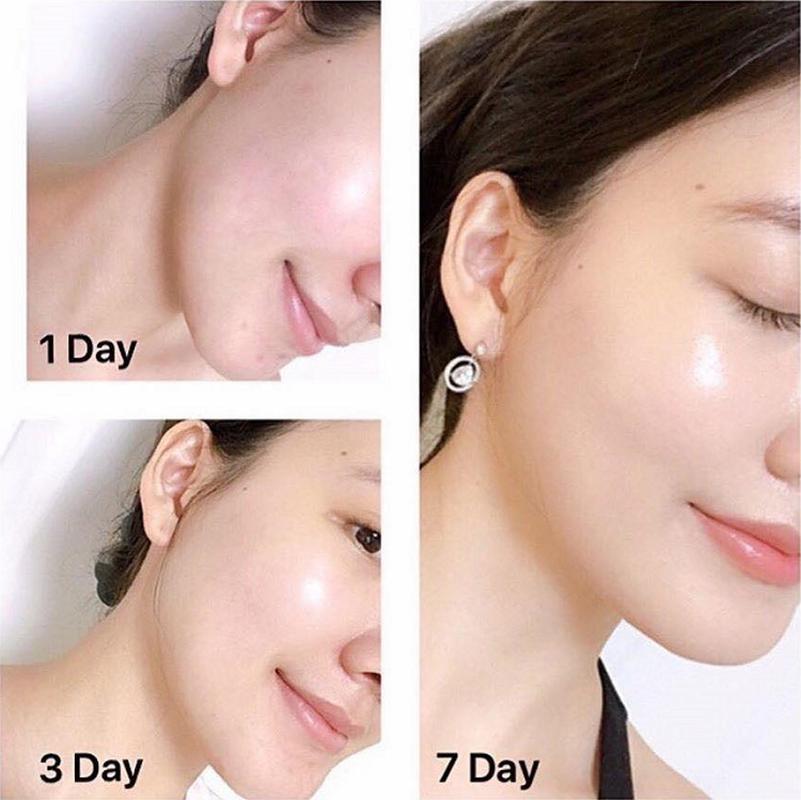 Kem dưỡng Olay ngày và đêm total effect
