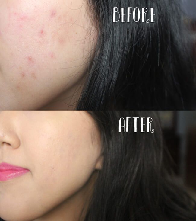 [HCM]KEM NỀN CHE KHUYẾT ĐIỂM DERMACOL MAKEUP COVER