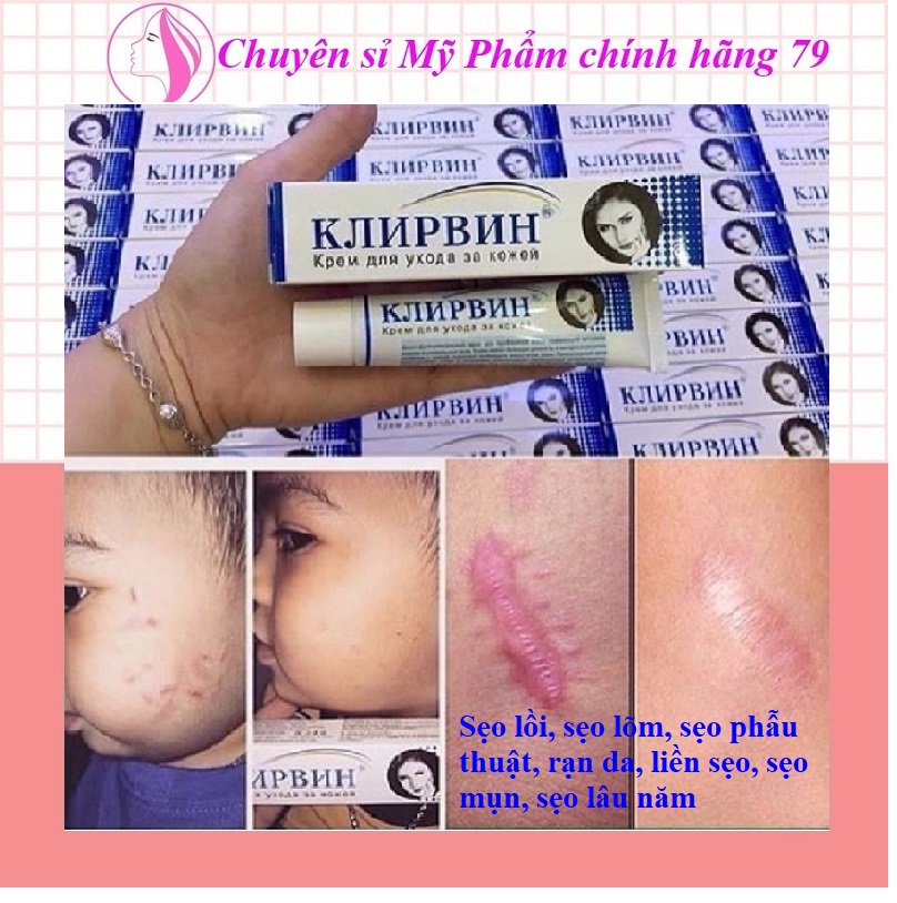 [Freeshipmax] [Combo 2 bottle] cream scar Russian scar intensive perennial scar pitting keloid scar recessed stretch marks scars Surgical