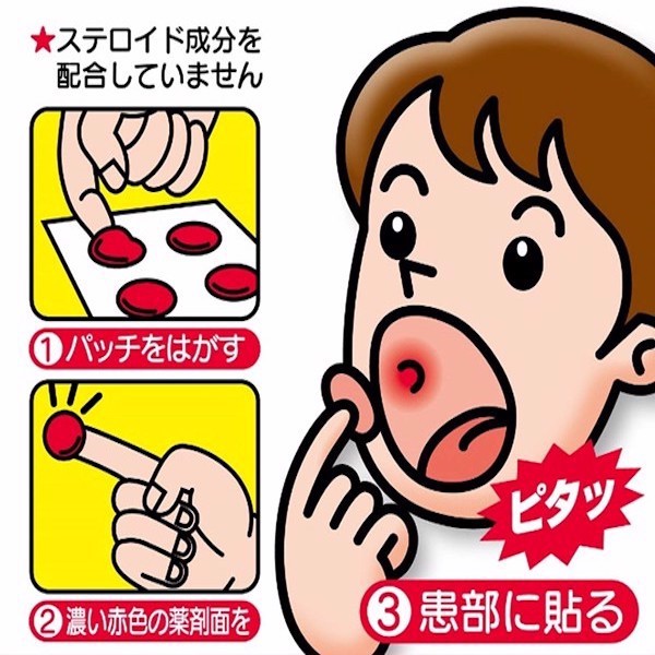 Miếng dán chữa loét miệng Taisho Quick Care