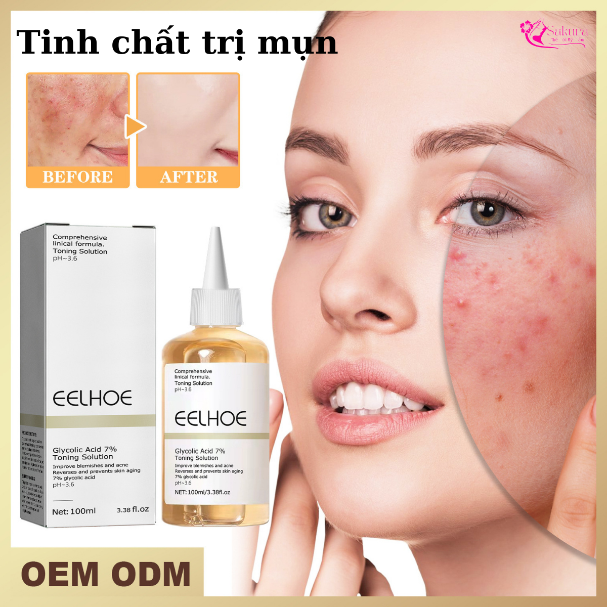 Tinh Chất Dưỡng Da Ngừa Mụn, cải thiện thâm mụn, ngăn ngừa lão hóa....giúp da tươi sáng mịn màng.