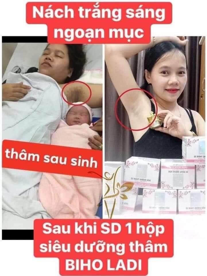 Siêu Dưỡng Thâm 5s Biho Ladi