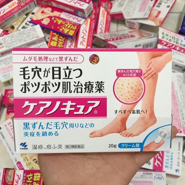 KEM VIÊM NANG LÔNG Kobayashi 30G