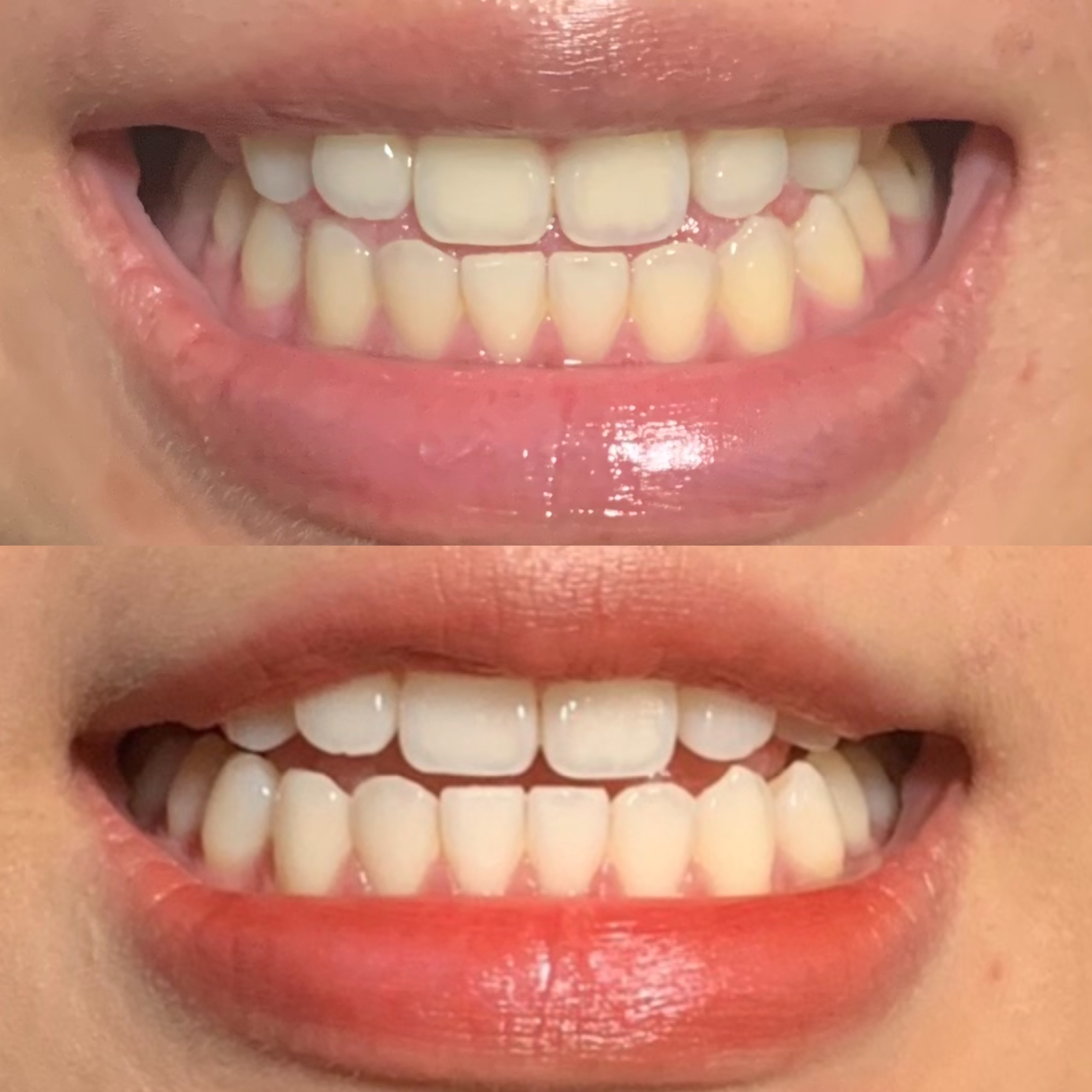 Bột Đánh Răng/Súc Miệng Làm Trắng Răng, Thơm Miệng 2in1 So Natural