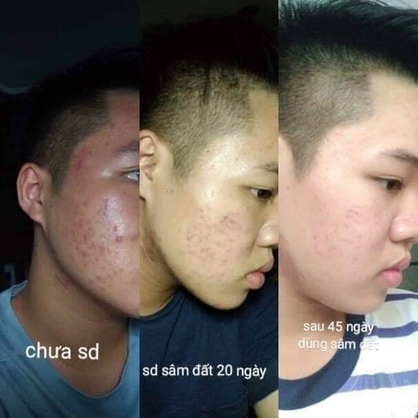 Tinh Chất Sâm Đất