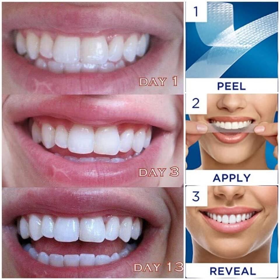(Combo 5 gói ) Miếng Dán Trắng Răng Crest 3D White Professional Effects siêu trắng Mỹ