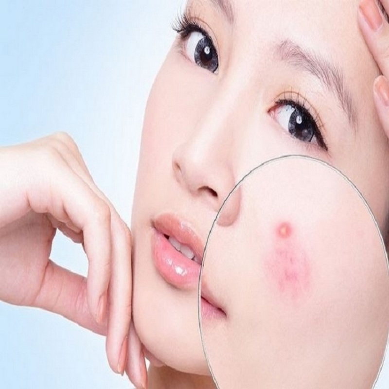 phấn ngừa mụn phấn nụ hoàng cung giá rẻ