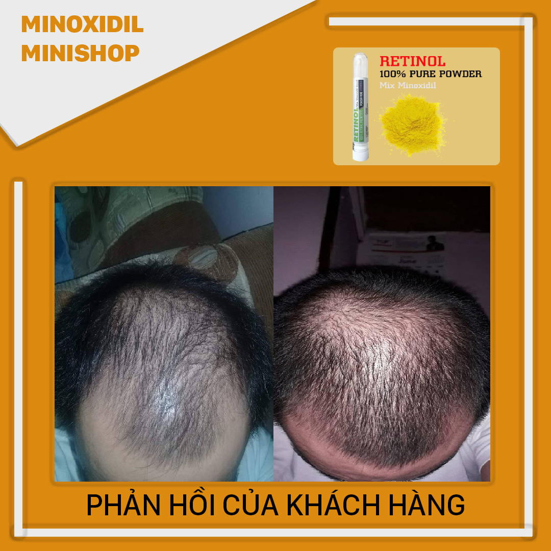 Retinol Giúp Mọc Râu Nhanh