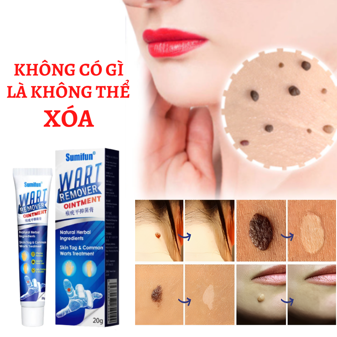 {HÀNG MỸ} ĐÁNH BẬT MỤN CÓC,MỤN THỊT,MỤN CƠM CỨNG ĐẦU lâu năm hiệu quả hàng chính hãng USA