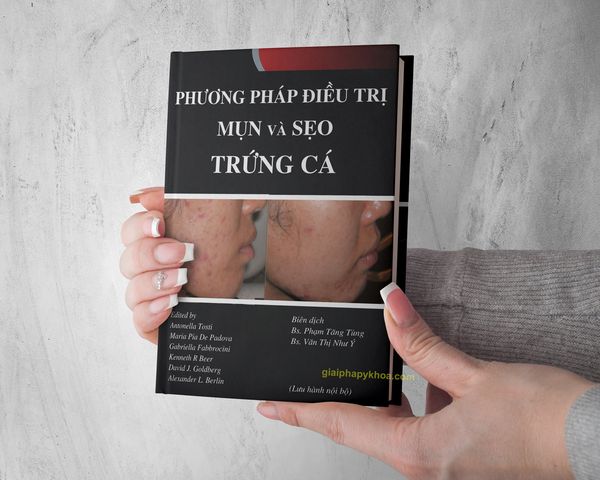 Sách thẩm mỹ về trứng cá