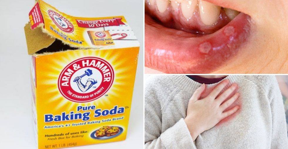 Baking soda 454g viethealthy