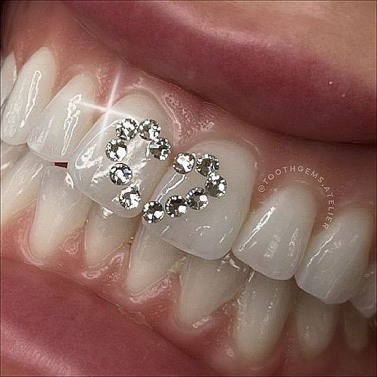 Kim Cương Nhân Tạo Đá Đính Răng Cao Cấp ( Size 2.7# Nhọn )