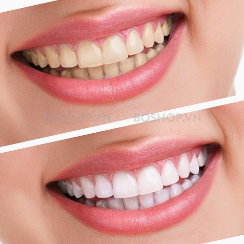 [HCM]Kem đánh răng Crest 3D advanced triple white