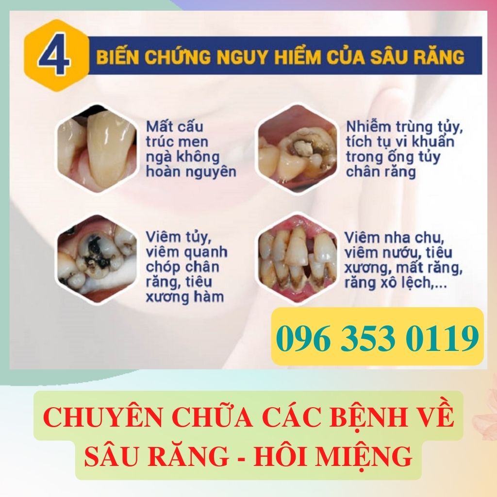✅[CHÍNH HÃNG] Chai Sâu Răng Người Dao Đỏ Sapa