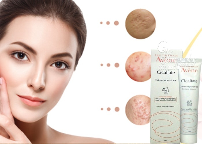 Kem liền sẹo, tái tạo da Avene Cicalfate+ 40ml Pháp