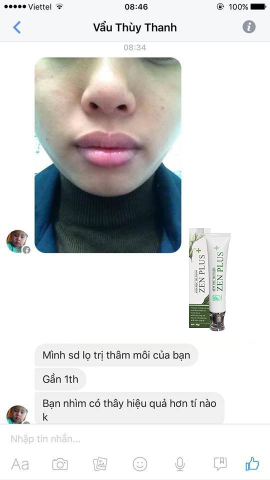 Kem Ngừa Thâm Nám Zen Plus+